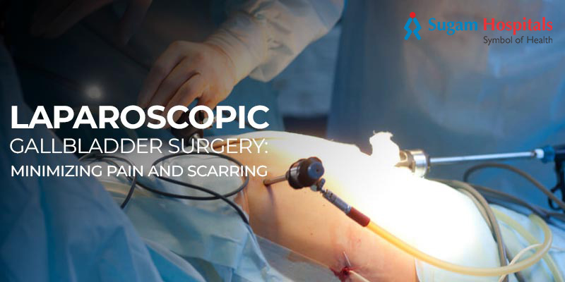 Laparoscopic Gallbladder Surgery: Minimizing Pain and Scarring